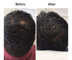 BEFORE AFTER - Male - Various male, categorised (10)