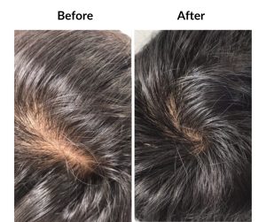 BEFORE AFTER - Male - Various male, categorised (14)