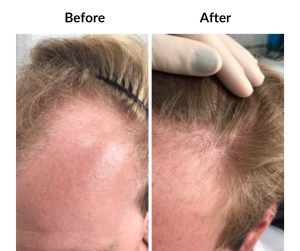 BEFORE AFTER - Male - Various male, categorised (2)